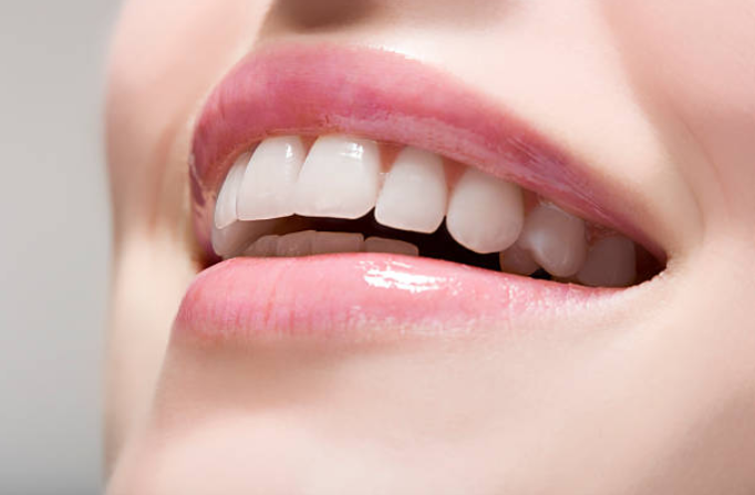 Los tratamientos dentales no desgastan los dientes