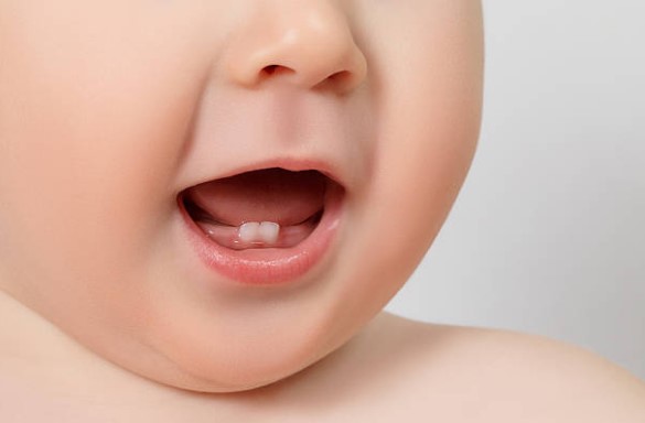Un golpe en un diente de leche… ¿Qué hacer?