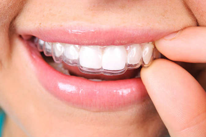 La ortodoncia, mucho más que un tratamiento estético