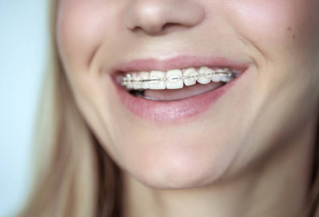 Preguntas sobre la ortodoncia