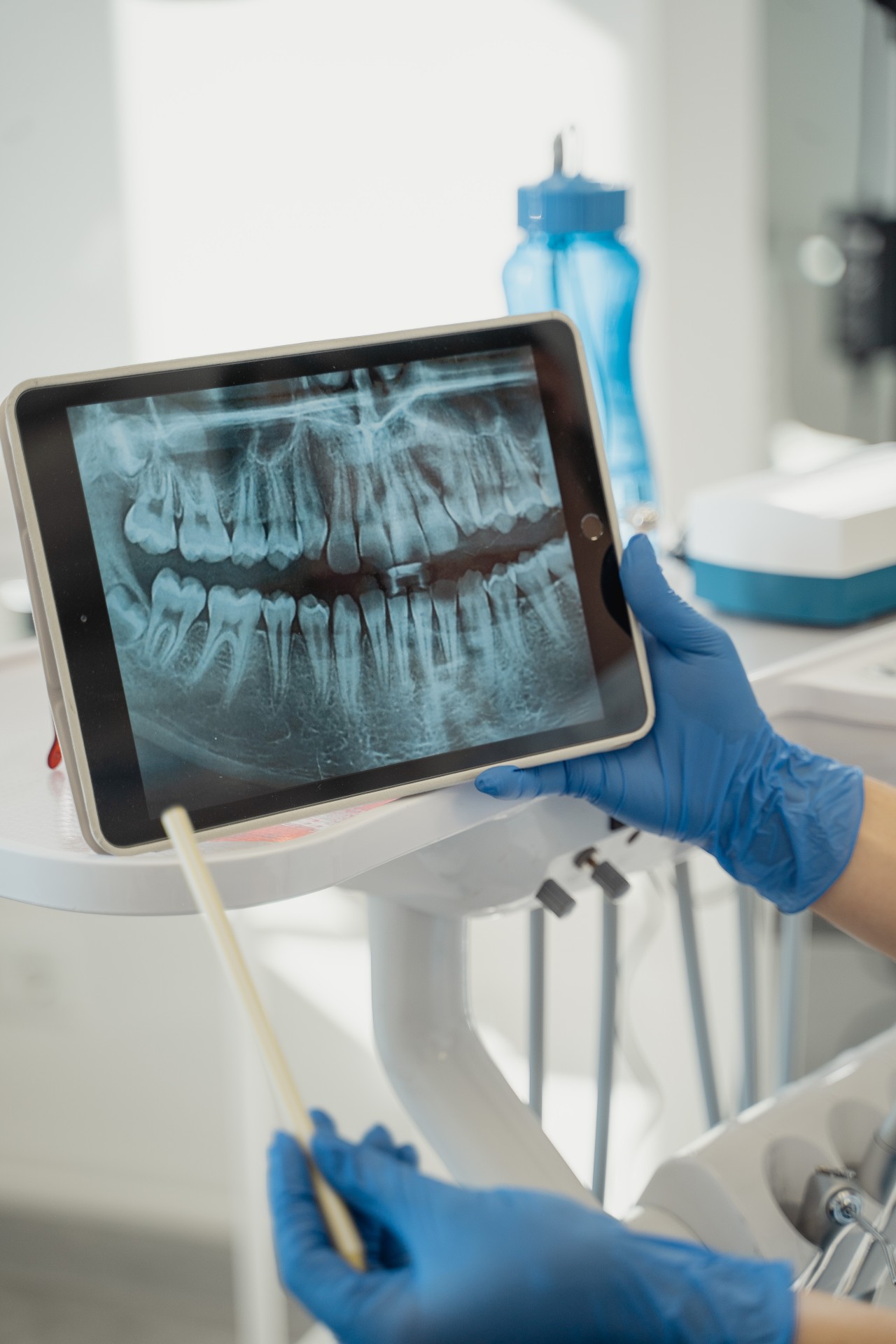La revolución en implantologia dental